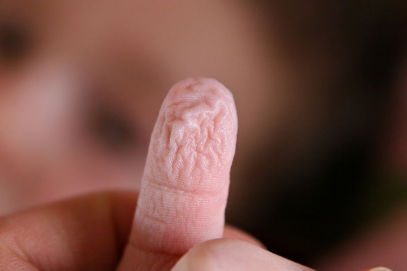 The science behind pruney fingers The science behind pruney fingers