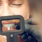 dental_implants_3